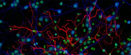 Technologische Fortschritte in der Fluoreszenzmikroskopie