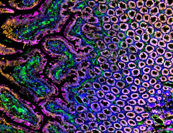 Immunfluoreszenzanalyse von Gefrierschnitten des Darms der Sprague-Dawley-Ratte mit Histon H3 (orange), Blutgefäßen (Lektin, grün), Aktin (magenta), und Zellkerne (blau) überlagert